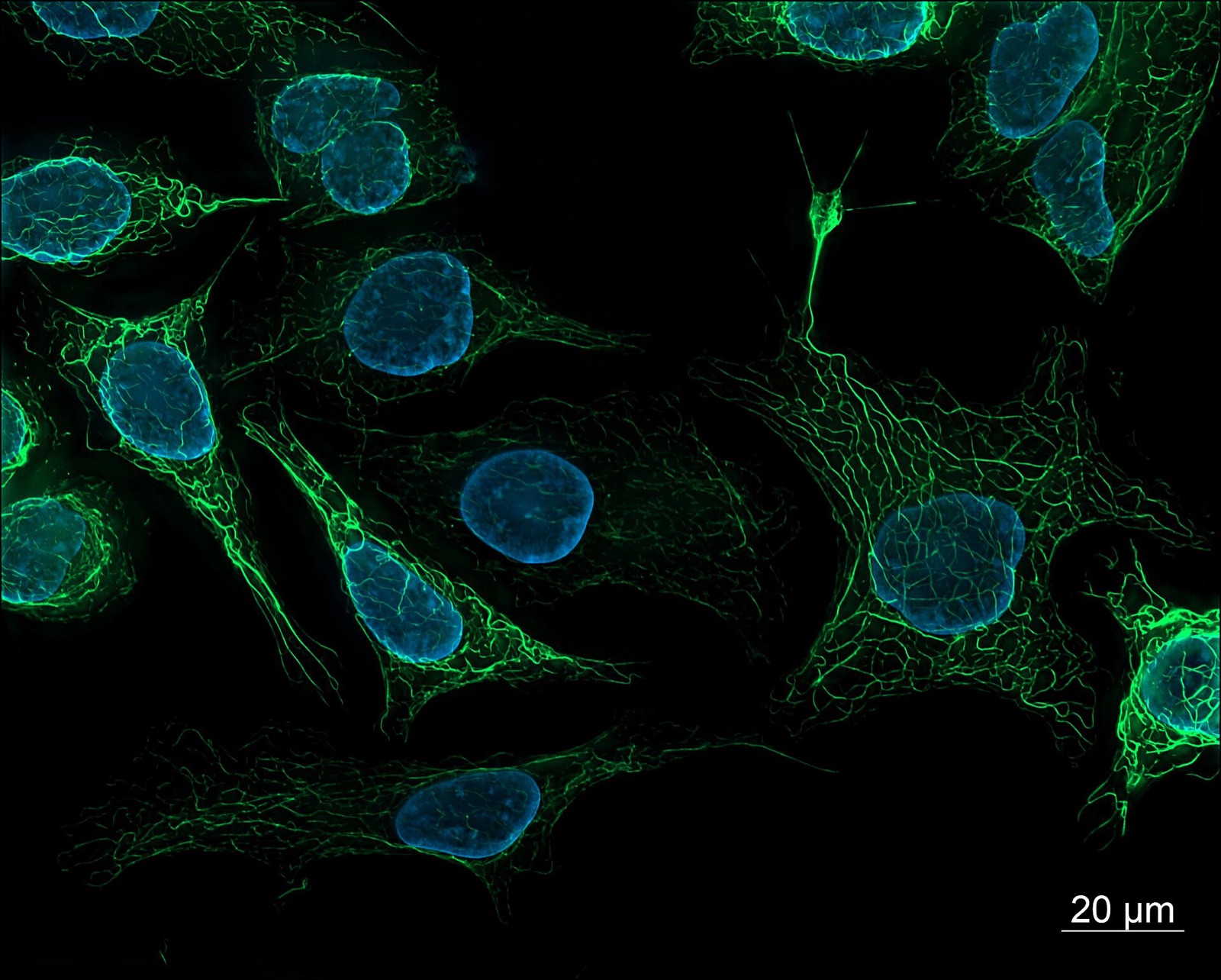 Human cells under fluorescence microscopy, nuclei glowing blue against a green cytoskeleton