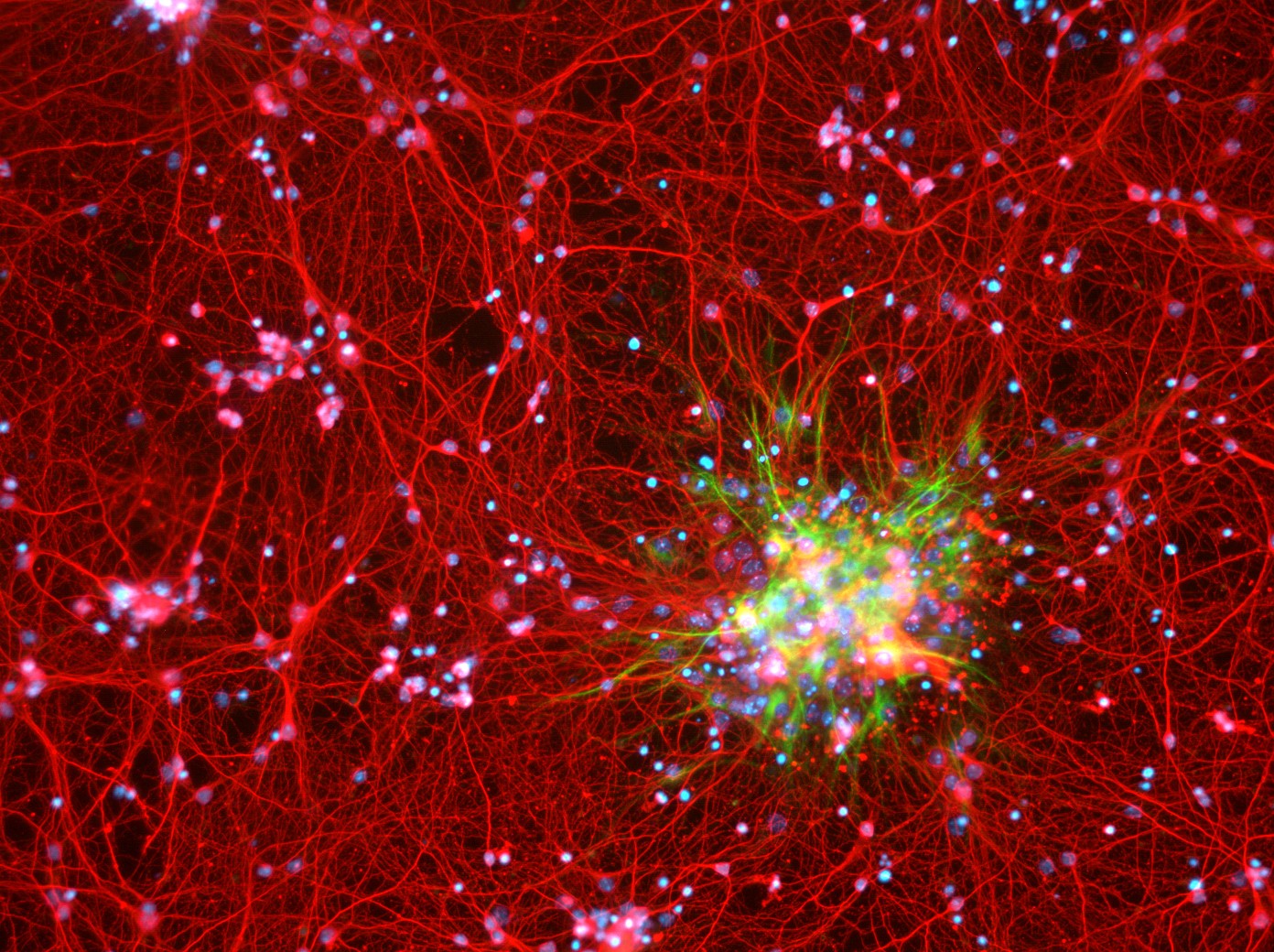 Fluorescence image of a dense network of brain cells radiating from a bright cluster
